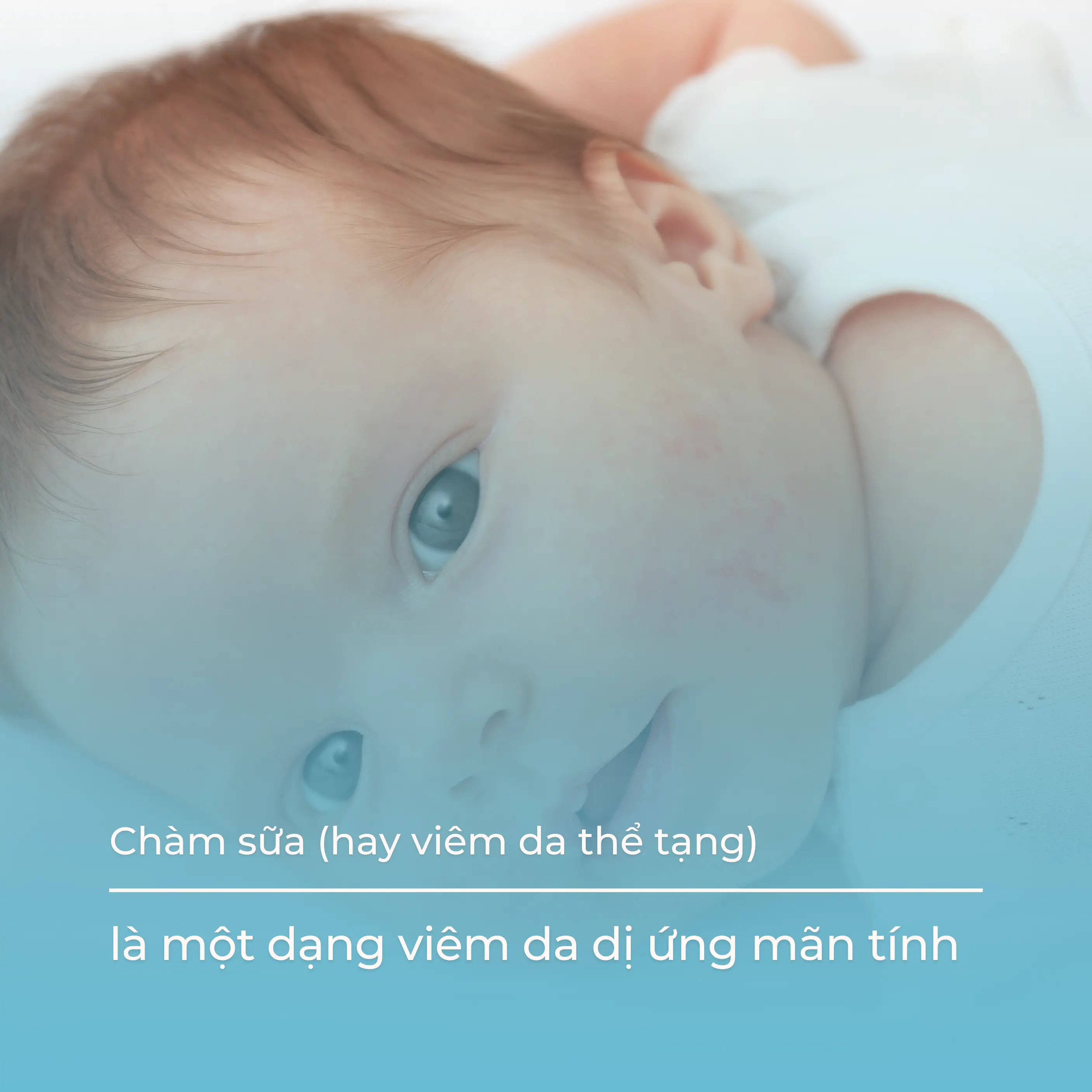 cham-sua-la-gi-noleo